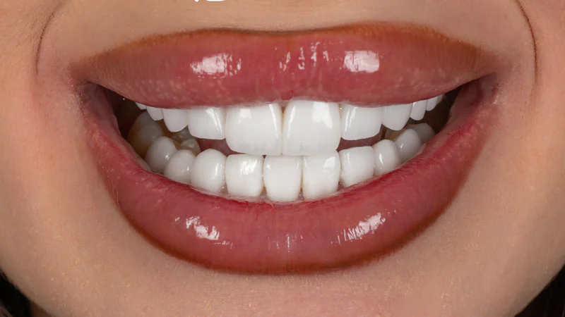 Smile photograph from the before and after collection 01