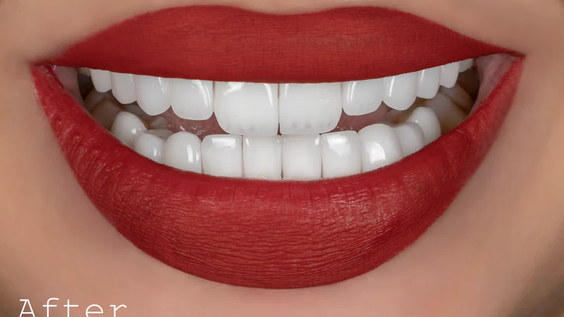 Smile photograph from the before and after collection 03