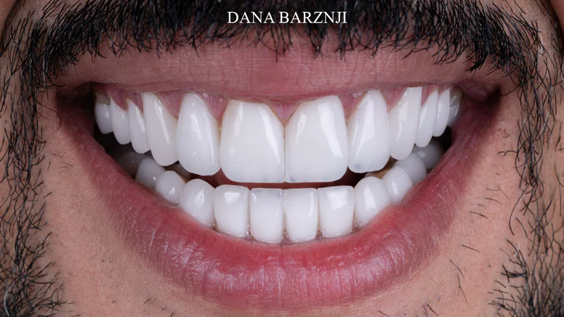 Smile photograph from the before and after collection 05