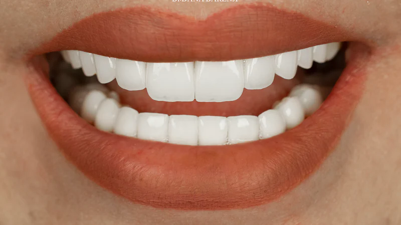 Smile photograph from the before and after collection 06
