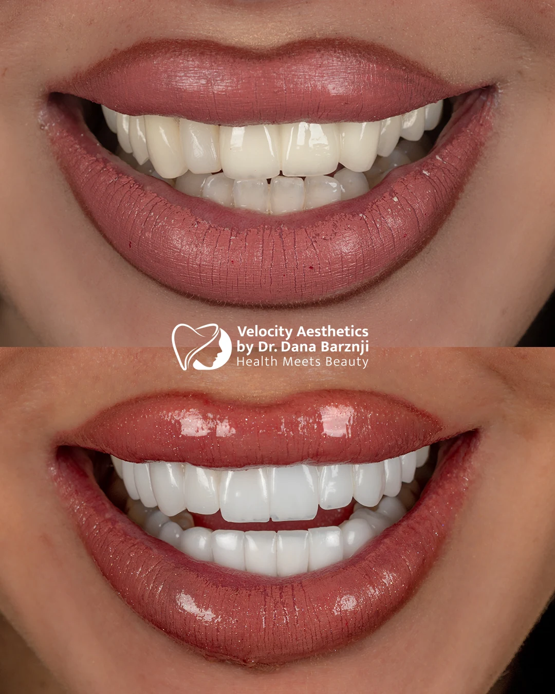 Smile 03: Original photograph · Before above, after below