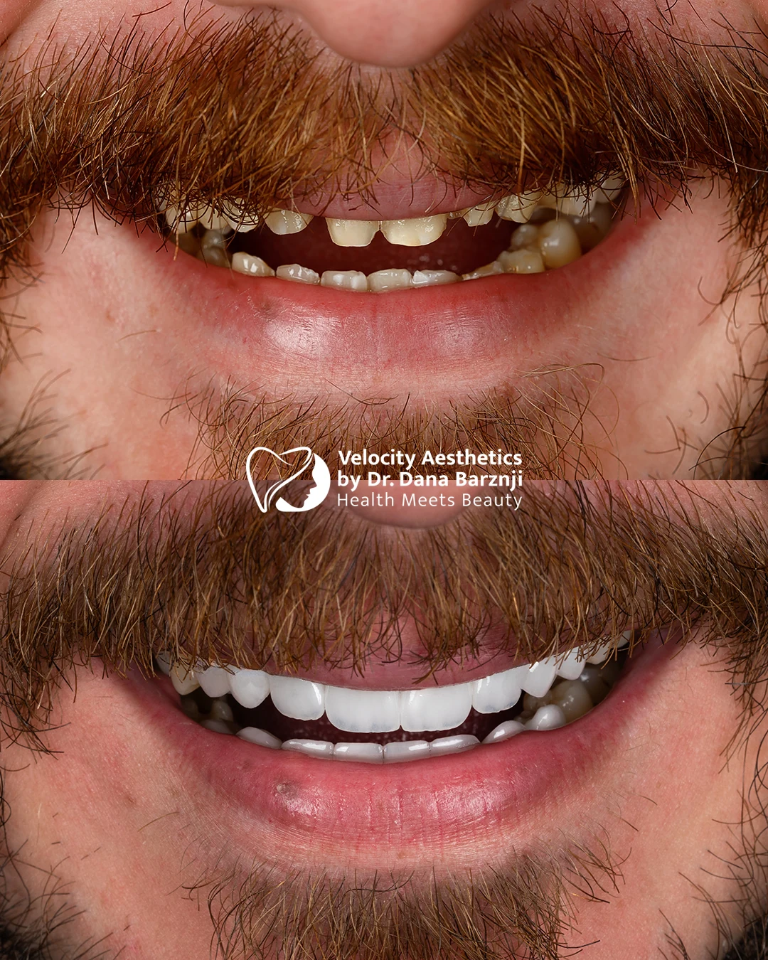 Smile 04: Original photograph · Before above, after below